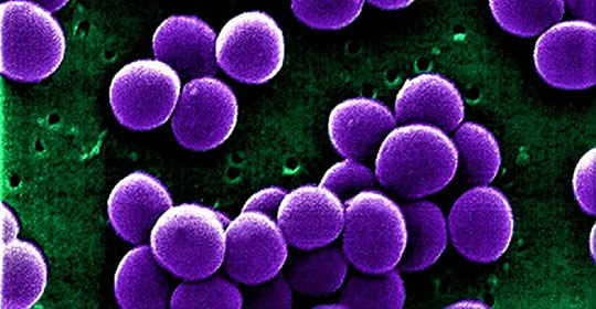 Infezioni da Staphylococcus aureus: via a uno studio clinico innovativo