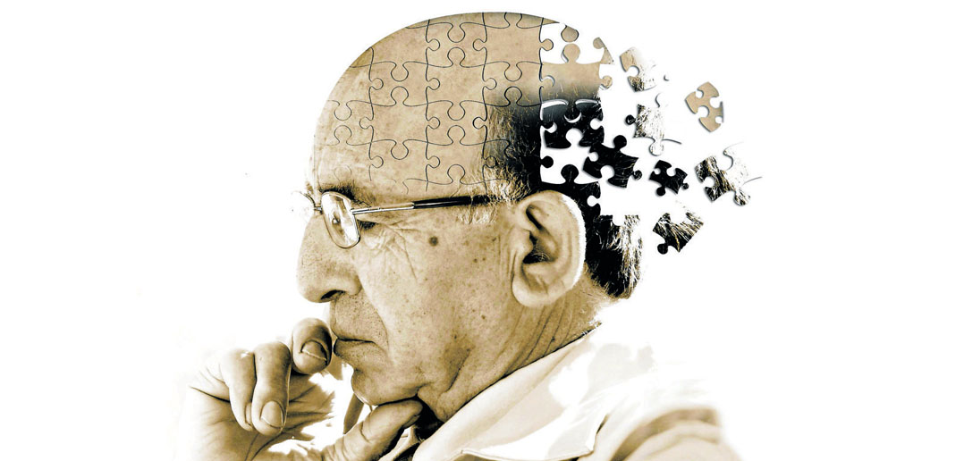 Morbo di Alzheimer, terminato lo studio clinico su un nuovo farmaco