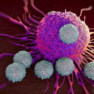 Cancro uroteliale, c’è una nuova terapia che raddoppia la sopravvivenza