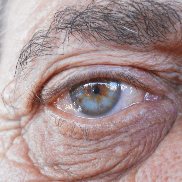 Scoperti 50 nuovi geni che determinano il colore degli occhi
