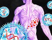 Herpes zoster, chi soffre di malattie reumatologiche a rischio riattivazione virus