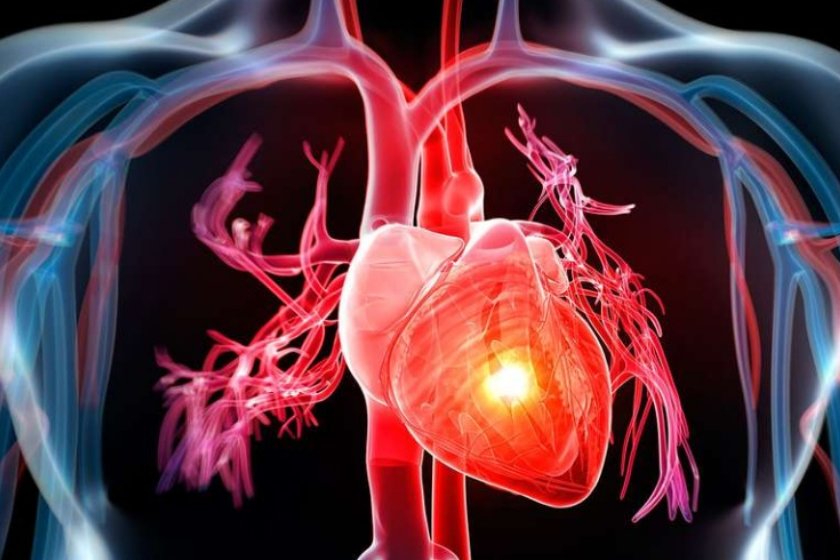 Scompenso cardiaco, primi studi promuovono sistema preCARDIA