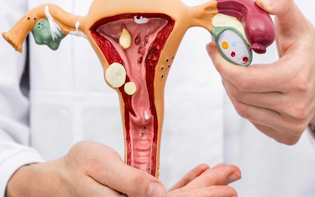 In Lombardia 160mila donne soffrono di endometriosi