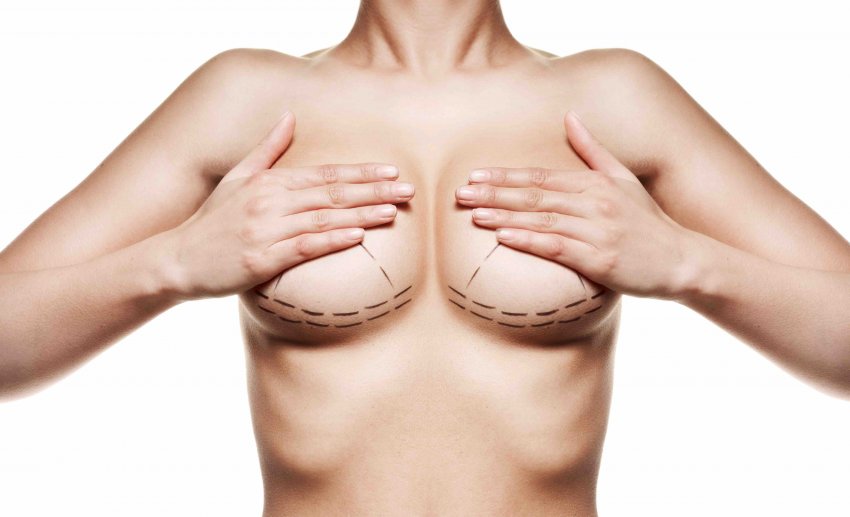 Il nuovo ruolo della medicina estetica all’interno di breast unit e obesity unit