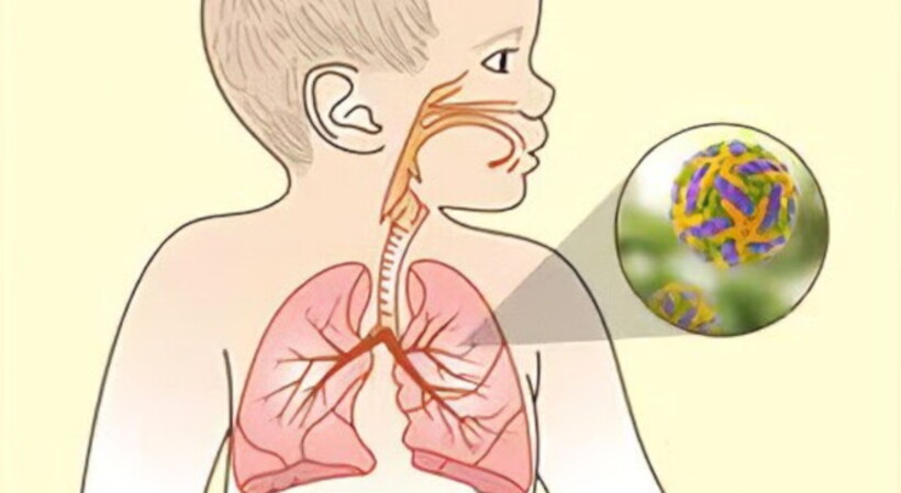 Virus respiratorio sinciziale, il 45% dei genitori non conosce la malattia