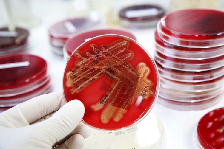 Parte da Pisa ‘Resistimit’, il registro dinamico per combattere i microbi multiresistenti