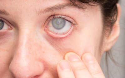Studio clinico LIGHTSITE III, LumiThera annuncia un miglioramento della vista sostenuto per 24 mesi nei soggetti affetti da degenerazione maculare secca