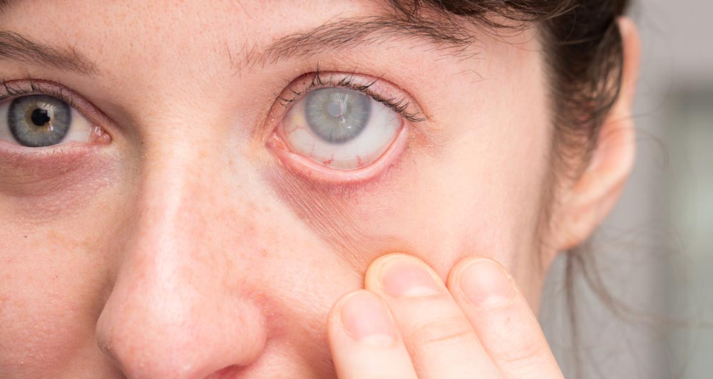 Studio clinico LIGHTSITE III, LumiThera annuncia un miglioramento della vista sostenuto per 24 mesi nei soggetti affetti da degenerazione maculare secca
