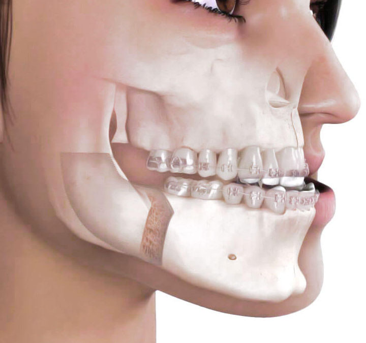 Da DentalMonitoring novità nel monitoraggio degli apparecchi ortodontici