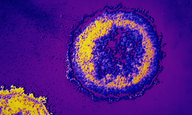 Hiv ed epatiti, da Simit l’appello a rafforzare test e trattamenti nella lotta alle infezioni