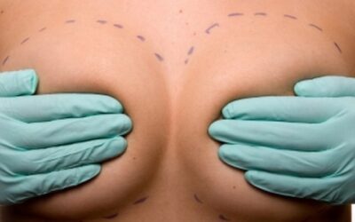 Un nuovo studio clinico indipendente dimostra la sicurezza e l’efficacia della protesi mammaria Perle