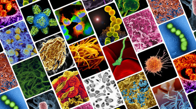 Top 5 in Infectious Diseases, a Venezia focus su anticorpi monoclonali, germi multi-resistenti e antibiotici